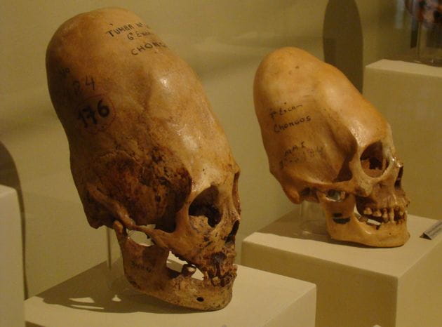 Crânios da cultura Paracas, do norte do Peru (500 a.C. - 200 d.C)